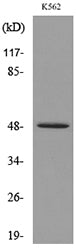 Kallistatin Rabbit Polyclonal Antibody