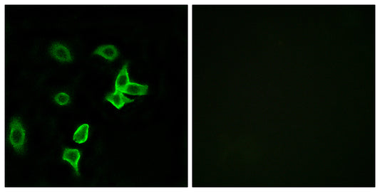 KANK2 Rabbit Polyclonal Antibody