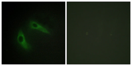 KChIP1 Rabbit Polyclonal Antibody