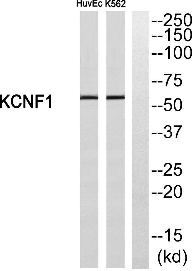 KCNF1 Rabbit Polyclonal Antibody