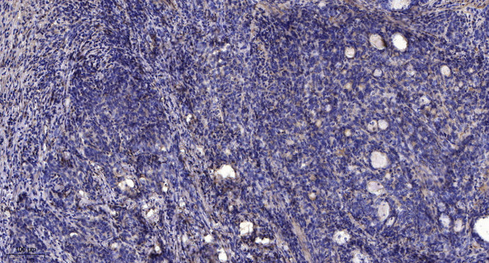 KCNH3 Rabbit Polyclonal Antibody