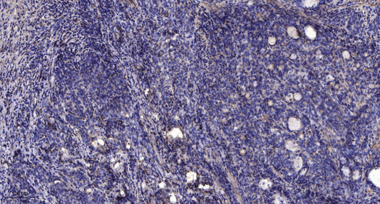 KCNH3 Rabbit Polyclonal Antibody