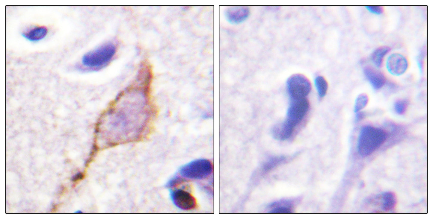 KCNQ2/3/4/5 Rabbit Polyclonal Antibody