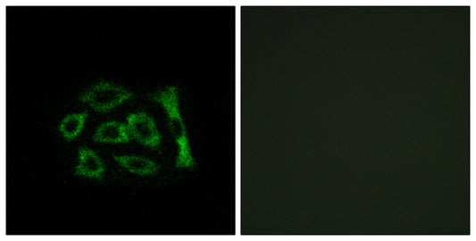 KDEL Receptor 2 Rabbit Polyclonal Antibody