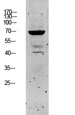 Keratin 5 Rabbit Polyclonal Antibody