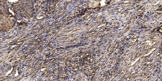 Keratin 77 Rabbit Polyclonal Antibody