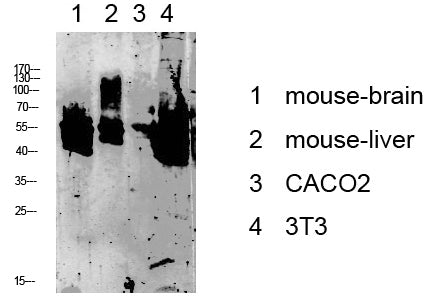 Keratin 8 Rabbit Polyclonal Antibody