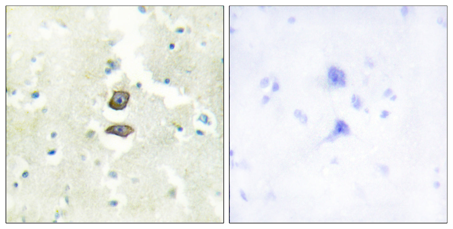 KG19 Rabbit Polyclonal Antibody