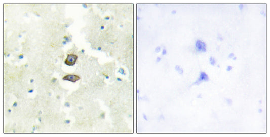 KG19 Rabbit Polyclonal Antibody