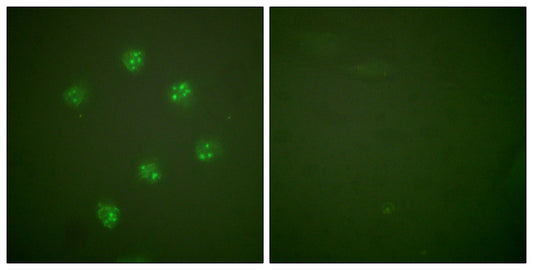 Ki-67 Rabbit Polyclonal Antibody