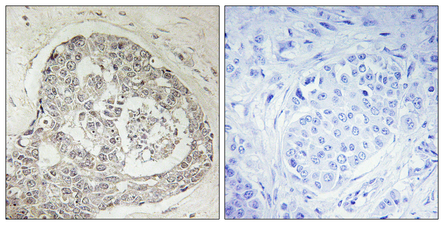 KIAA0100 Rabbit Polyclonal Antibody