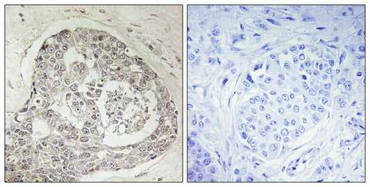KIAA0100 Rabbit Polyclonal Antibody