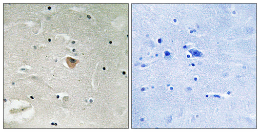KIF13B Rabbit Polyclonal Antibody
