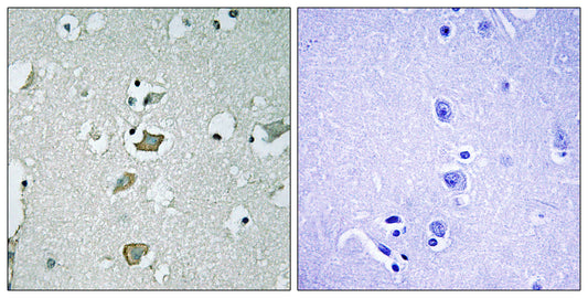 KIR2.1 Rabbit Polyclonal Antibody