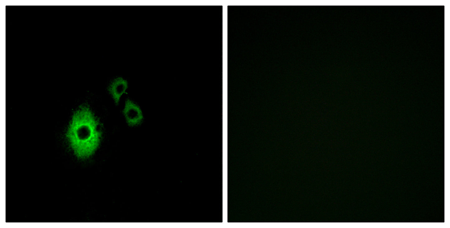 KIR3.4 Rabbit Polyclonal Antibody
