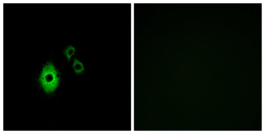 KIR3.4 Rabbit Polyclonal Antibody