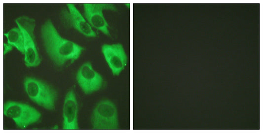 KIR5.1 Rabbit Polyclonal Antibody