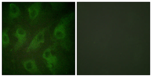 KIR6.2 Rabbit Polyclonal Antibody
