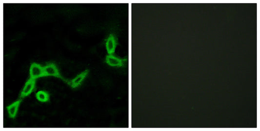 KiSS-1R Rabbit Polyclonal Antibody