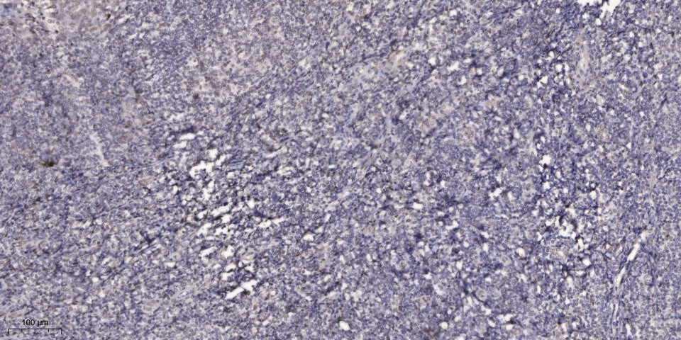 KLF8 Rabbit Polyclonal Antibody