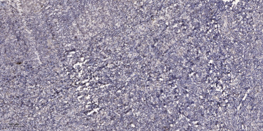KLF8 Rabbit Polyclonal Antibody