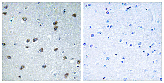 KLHL29 Rabbit Polyclonal Antibody