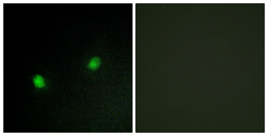 KOX4 Rabbit Polyclonal Antibody