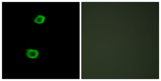 KPI-2 Rabbit Polyclonal Antibody