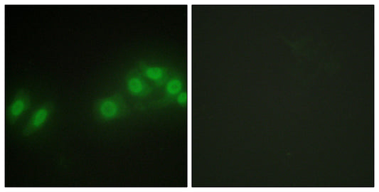 Kpm Rabbit Polyclonal Antibody