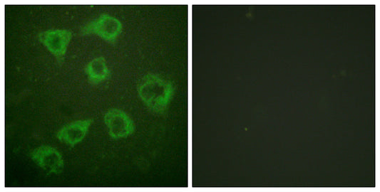 Ksr-1 Rabbit Polyclonal Antibody