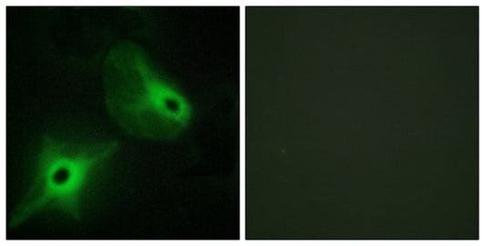 Ksr2 Rabbit Polyclonal Antibody