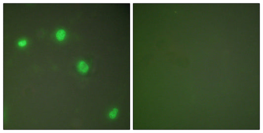Ku-70 Rabbit Polyclonal Antibody