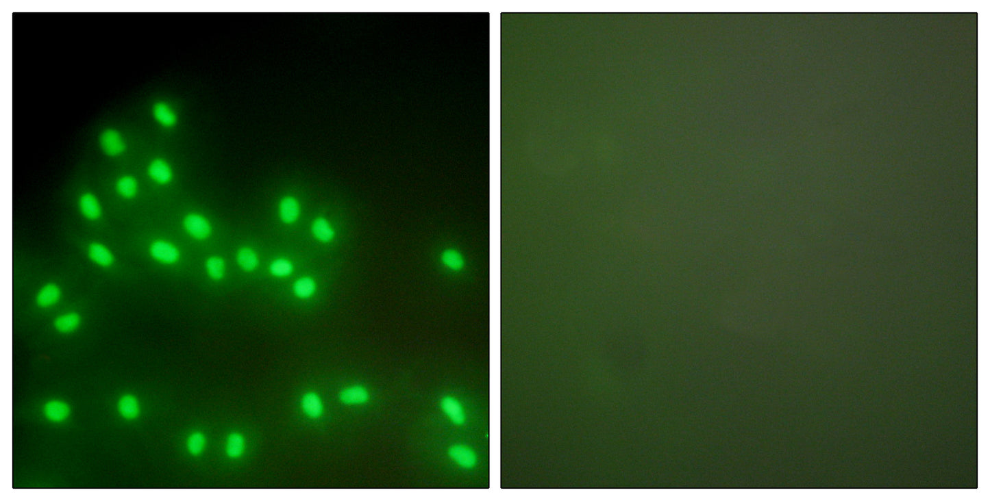 Ku-80 Rabbit Polyclonal Antibody