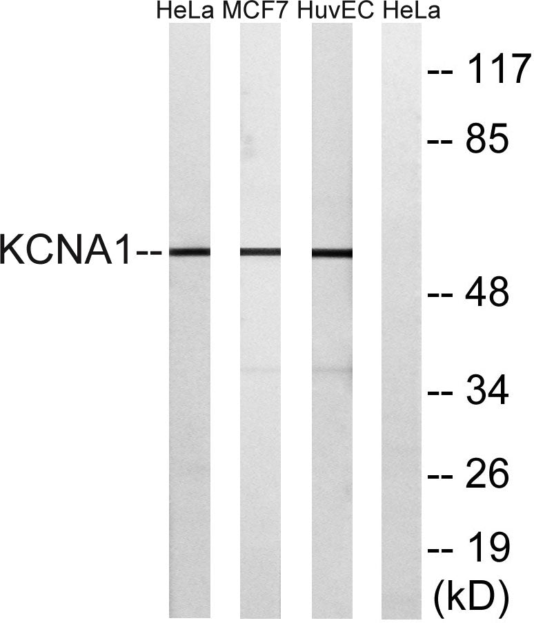 KV1.1 Rabbit Polyclonal Antibody