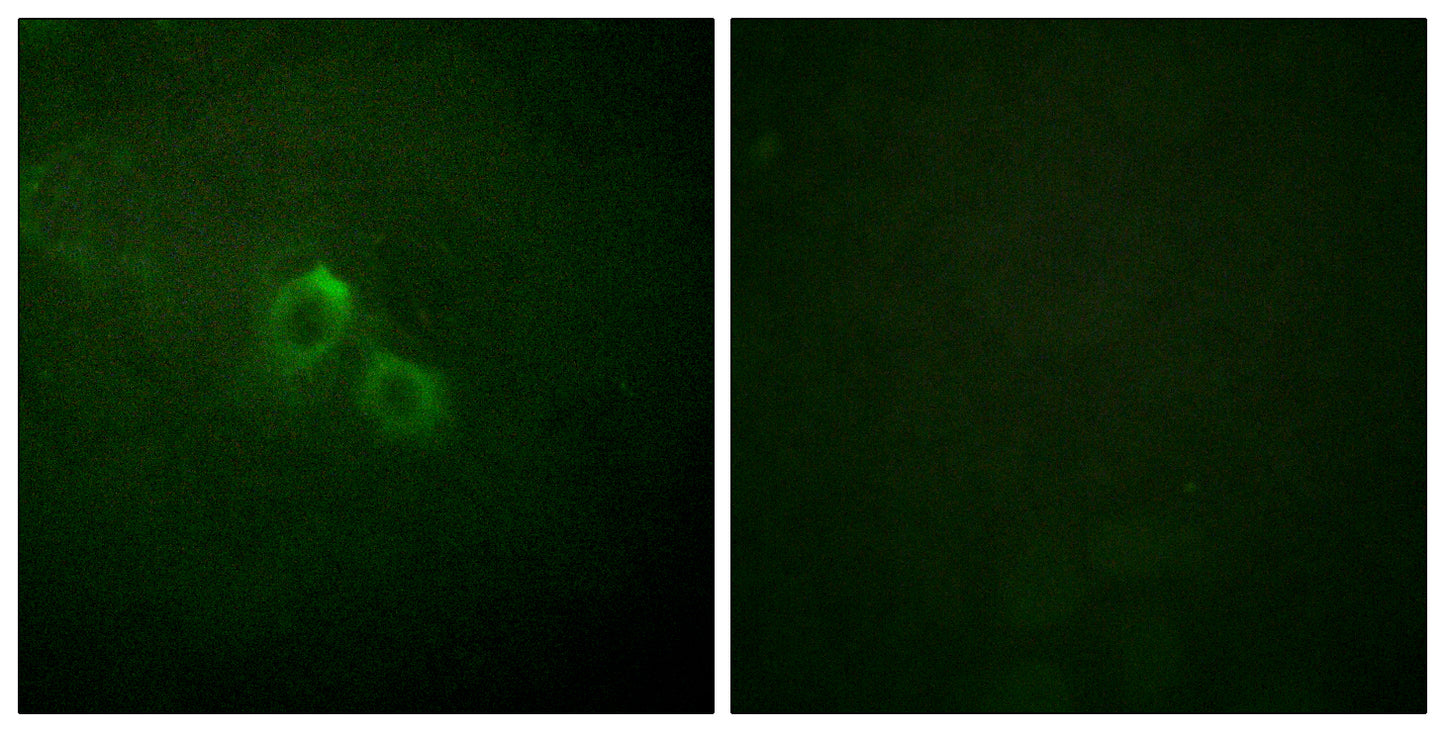 Kv1.3 Rabbit Polyclonal Antibody