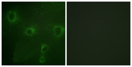 Kv2.1 Rabbit Polyclonal Antibody