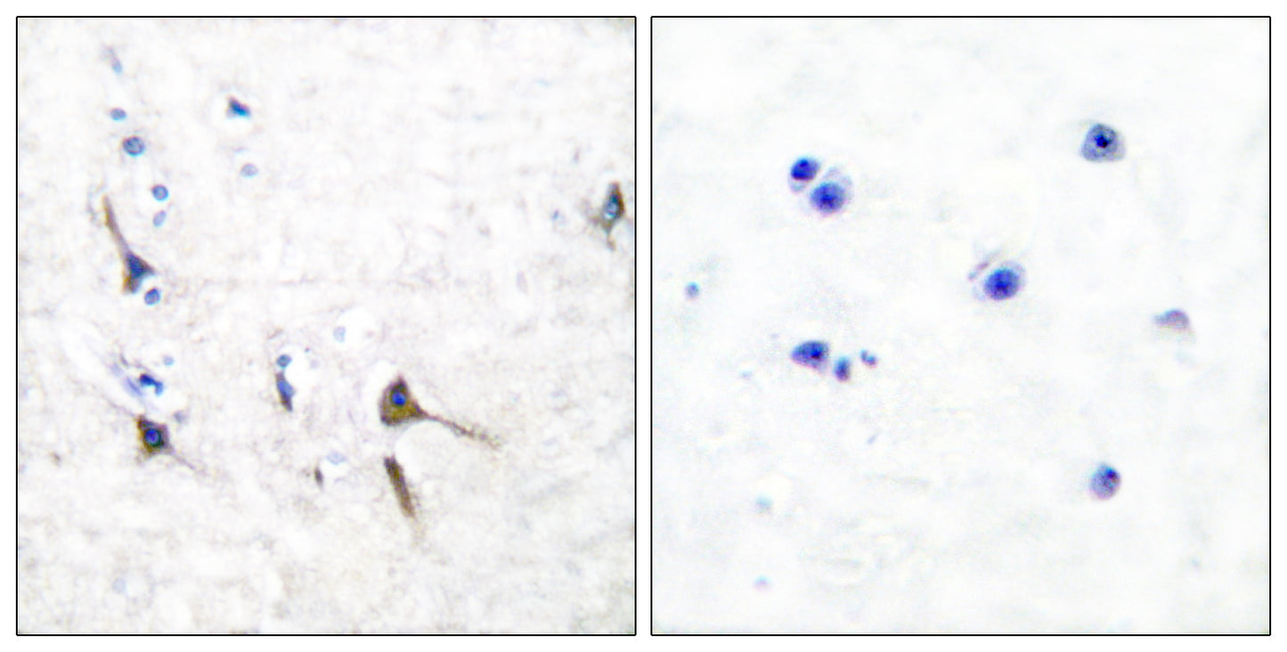 KV3.2 Rabbit Polyclonal Antibody