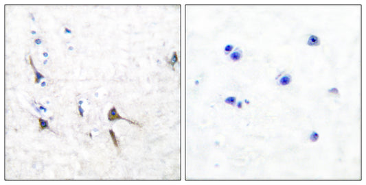 KV3.2 Rabbit Polyclonal Antibody
