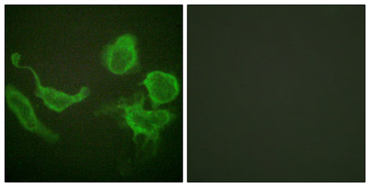 Kv3.4 Rabbit Polyclonal Antibody
