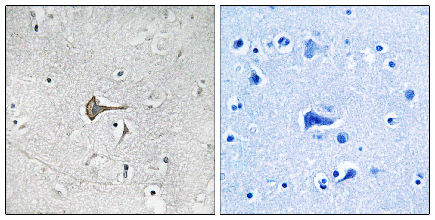 Kv4.2 Rabbit Polyclonal Antibody