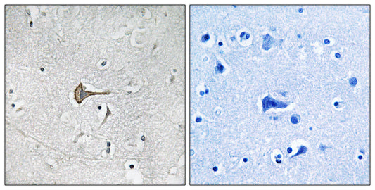 Kv4.2 Rabbit Polyclonal Antibody
