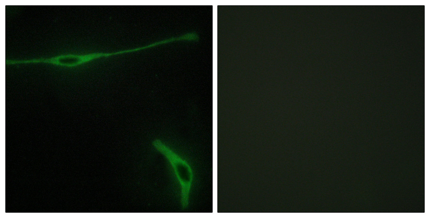 Laminin α-2 Rabbit Polyclonal Antibody