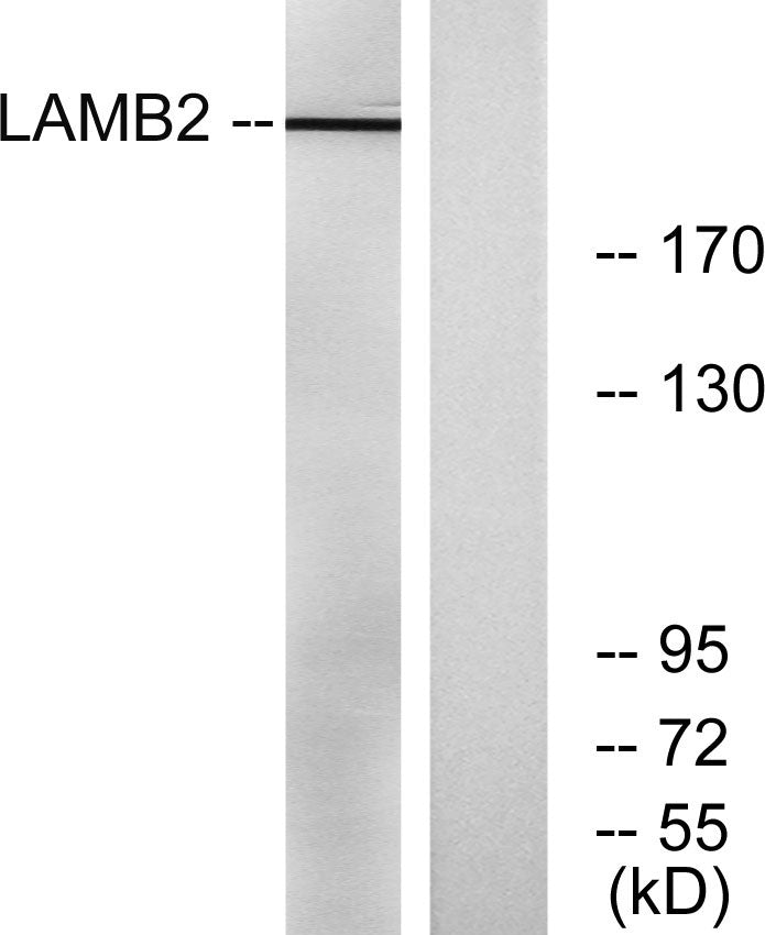 Laminin β-2 Rabbit Polyclonal Antibody