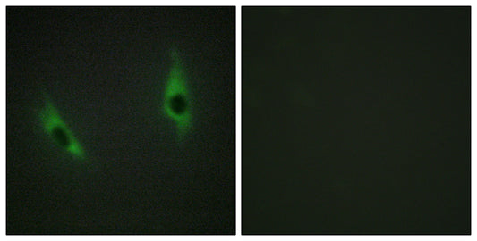 Laminin β-3 Rabbit Polyclonal Antibody