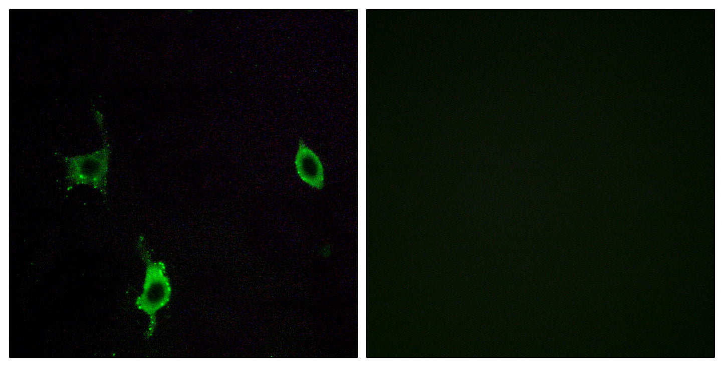 Laminin γ-3 Rabbit Polyclonal Antibody