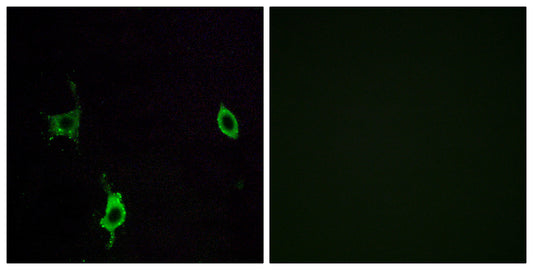 Laminin γ-3 Rabbit Polyclonal Antibody