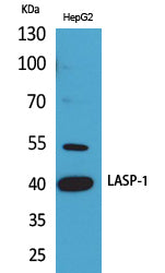 LASP-1 Rabbit Polyclonal Antibody