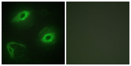 Latherin Rabbit Polyclonal Antibody
