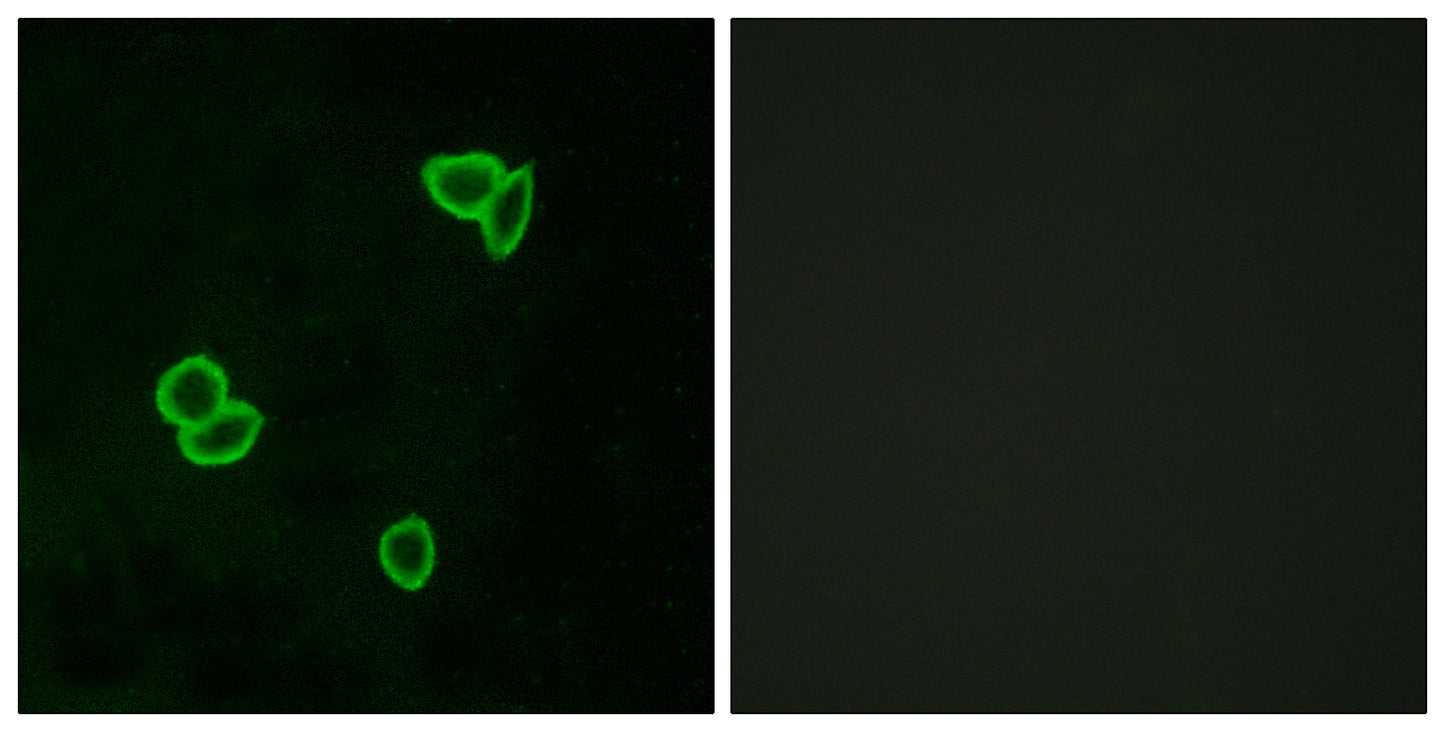 Latrophilin-1 Rabbit Polyclonal Antibody