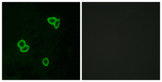 Latrophilin-1 Rabbit Polyclonal Antibody